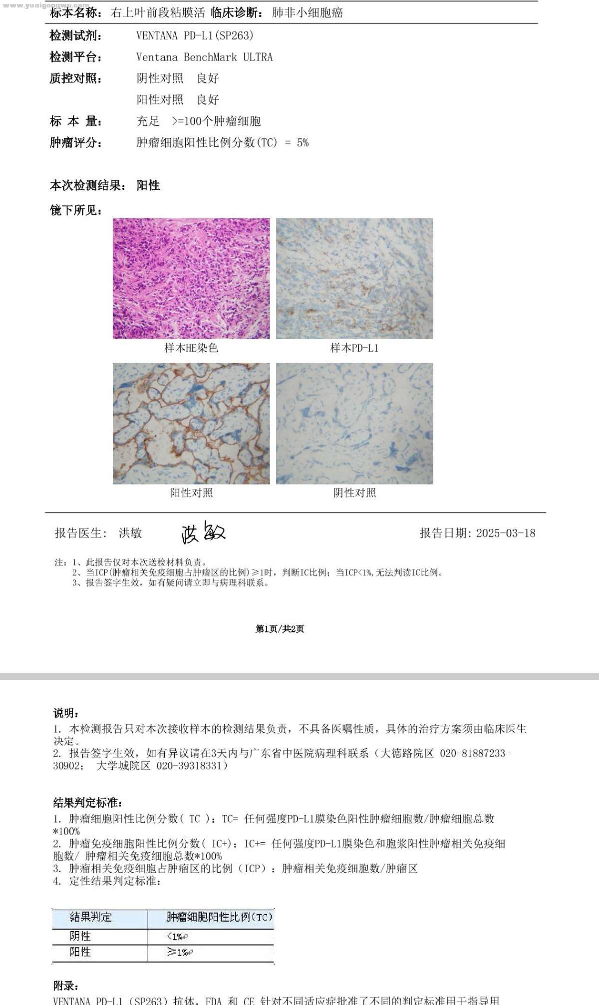 时隔三年，爸爸不幸也患上肺腺癌，Kras G12C突变，STK11突变，TP53突变，求助